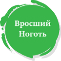 Вросший ноготь