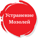 Устранение мозолей